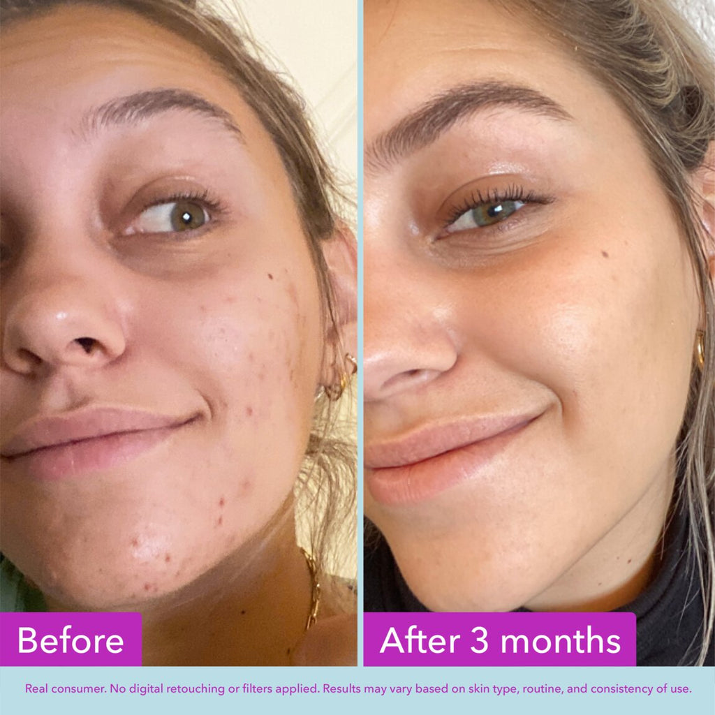 Niacinamide Brightening Toner Z8