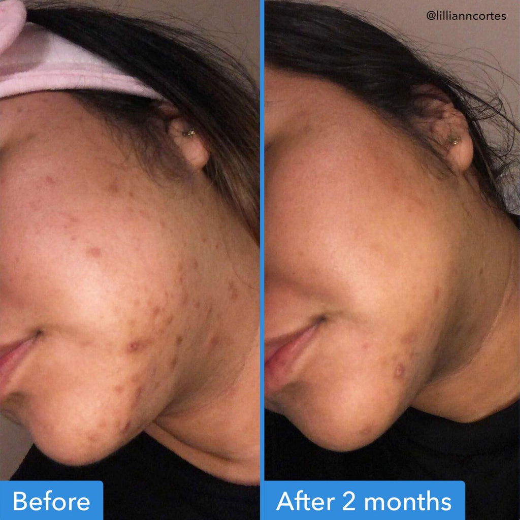Discoloration Correcting Serum C8