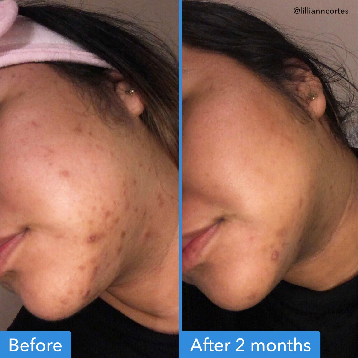 Discoloration Correcting Serum C8
