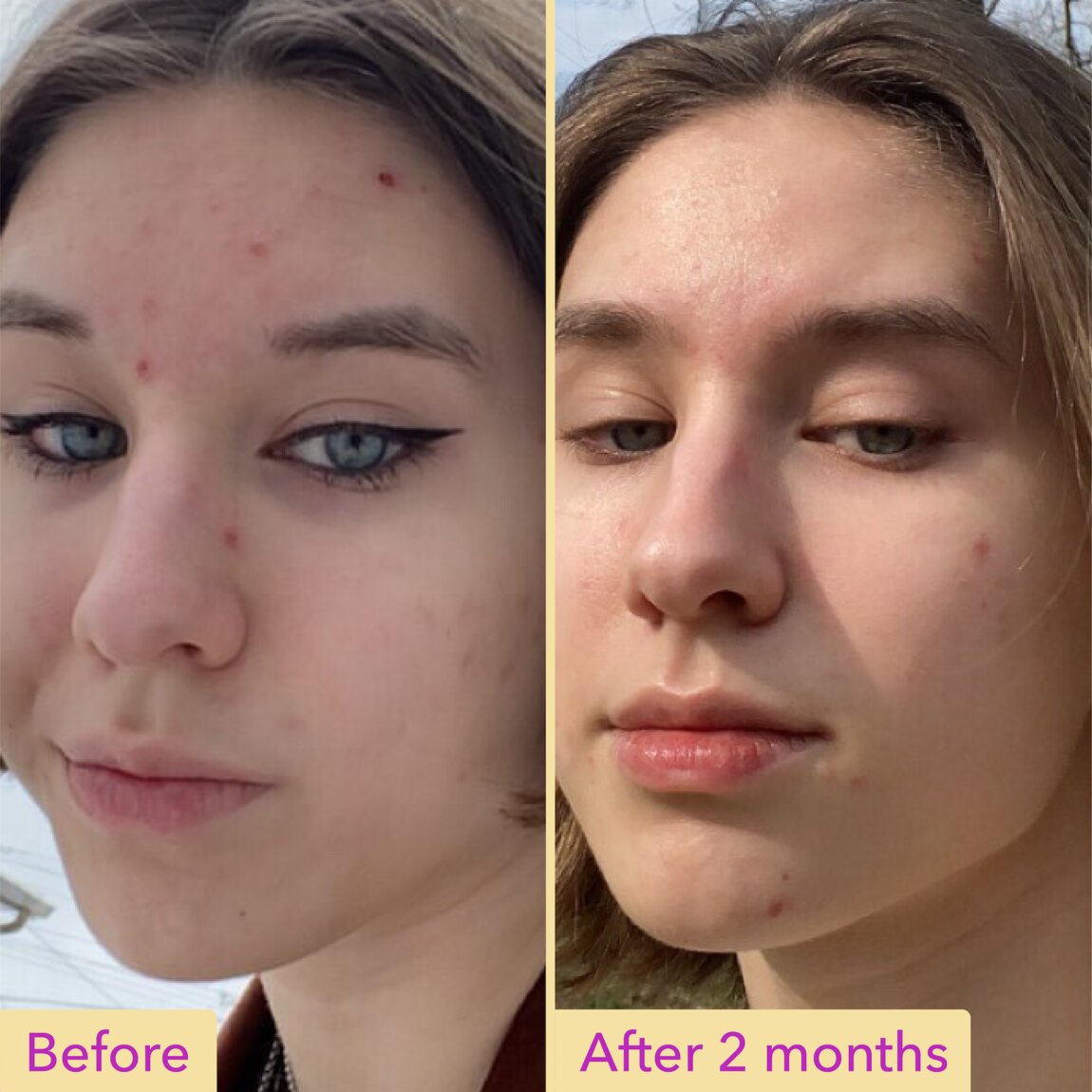 Niacinamide Serum U8